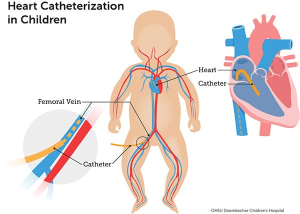 Cath Lab