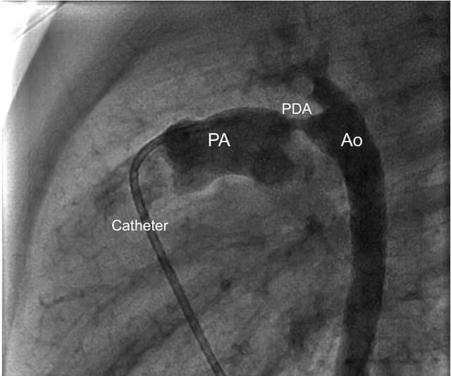 Cath Lab